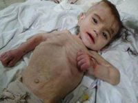 Suriye'deki Savaş 6 Milyon Çocuğu Etkiledi!