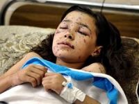 9 Yaşındaki Dinanın Gözleri Siyonist Mermiyle Kapandı