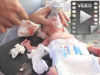 Yaralı Bebeğin Hayata Tutunma Çabası