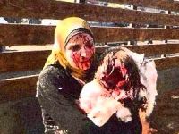 Suriye’de Dün: 15’i Çocuk 75 Şehit