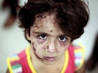 370 Binden Fazla Çocuğun 'Psiko-Sosyal' Yardıma İhtiyacı Var