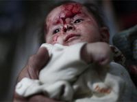 Suriye’de 22’si Çocuk 121 Şehit (FOTO)