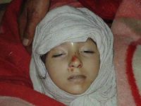 10’u Kadın, 8’i Çocuk 88 Kişi Katledildi