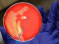 ABD Yanlışlıkla Canlı Şarbon Bakterisi Göndermiş