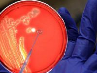 ABD'deki Şarbon Krizi Büyüyor