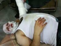 Esed Güçlerinin Füze Saldırısında AA Muhabiri Yaralandı