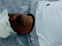 Kürt Müzisyen HDP/PKK Aleyhine Konuştu, Hastanelik Oldu!