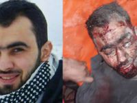 Direnişin Cesur Sesi Hadi Abdullah Ağır Yaralandı