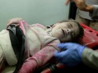 Halep'in Çocuklarına Bombalar Yağıyor