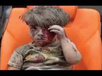 Rus Saldırısında Yaralanan Umran Bebeğin Durumu Ağır