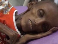 “Yemen’de Gerçekten Korkunç Bir Durum Var”