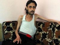 “Kuşatma Altındaki Halep’te Durum Çok Kötü”