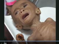 Yemen'in Yarısı Yiyecek Sıkıntısı Çekiyor