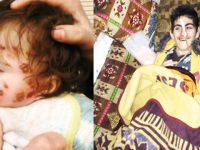 “Azez’de 20 Günde 14 Çocuk Hayatını Kaybetti”