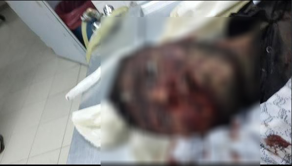 pkklilarin-katlettigi-huda-parlilar-diyarbakir-koyder04.jpg pkklilarin-katlettigi-huda-parlilar-diyarbakir-koyder04.jpg