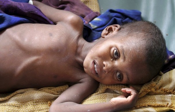 somali-aclik-kitlik02.jpg somali-aclik-kitlik02.jpg