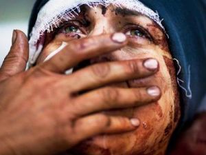Her Türlü Zulmün Beşiği Suriye'den Kör Dünyaya Haykırış