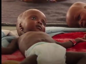 Nijerya’da Günde 2 Bin 300 Çocuk Açlıktan Ölüyor
